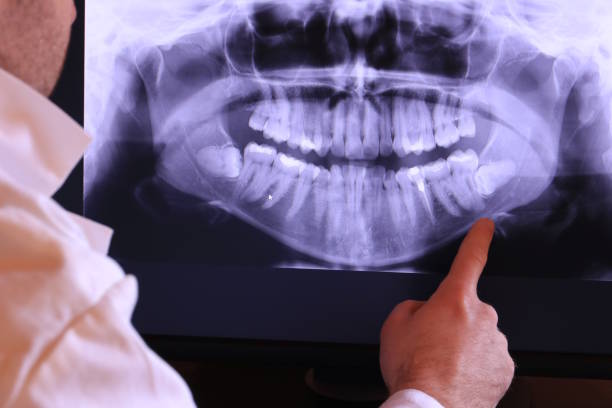 Best Emergency Cosmetic Dentistry in Mec, CA