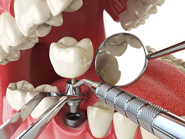 Best Mobile Emergency Dentist in Mec, CA